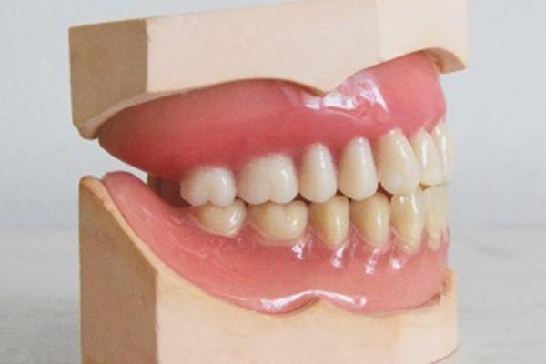 Image depicts full dentures on a denture mould.